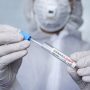 Testy na koronawirusa - kiedy i jaki test wykonać?
